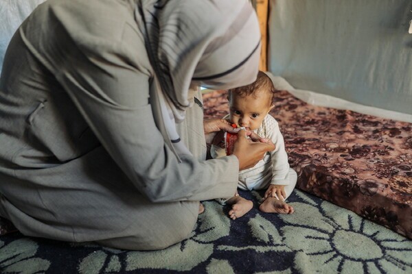 영양실조 치료식을 먹고 있는 가자지구의 영유아